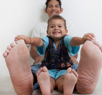  El venezolano que tiene el pie más grande del mundo