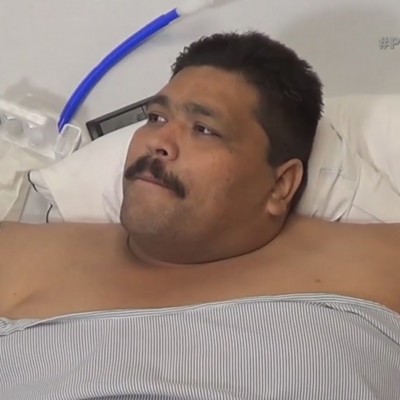  Muere Andrés Moreno, el hombre más obeso del mundo, después de unos meses de ser operado